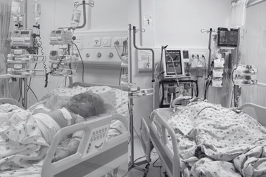 Hai cháu bé bỏng thương tâm, nghi bị cha ruột tưới xăng châm lửa đốt